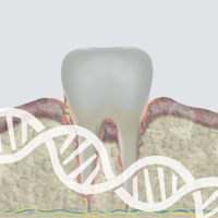 Uncovering the Progression of Gingivitis to Periodontitis